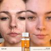 REN RADIANCE READY STEADY GLOW DAILY AHA TONIC before and after model face